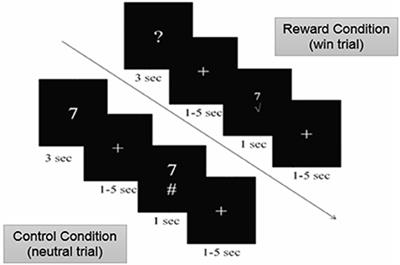 Neural Correlates of Outcome Anticipation in Multiple Sclerosis